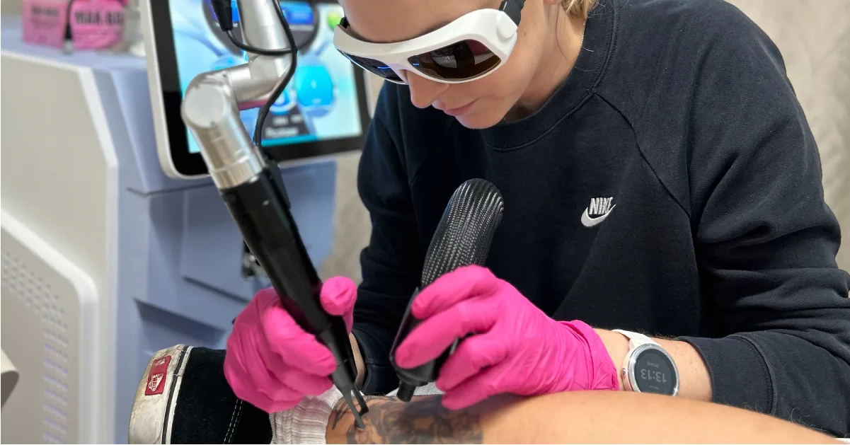 Odstránenie tetovania laserom, Grow Ink Up Laser Košice